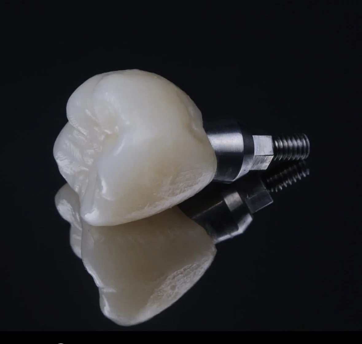 Metal-free Implant Supported Crowns and Bridges