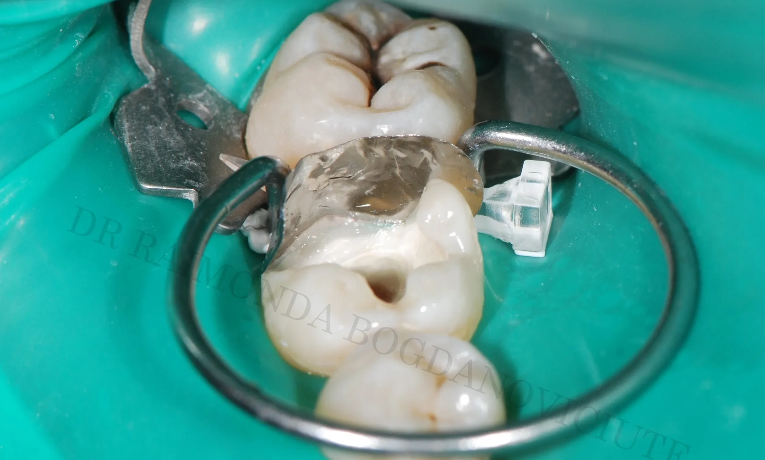 Functional Restorations