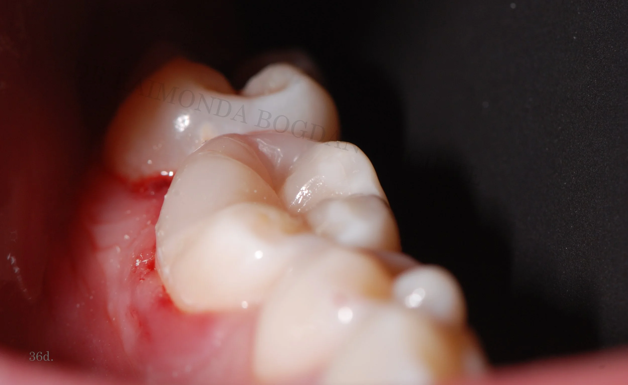 Functional Restorations