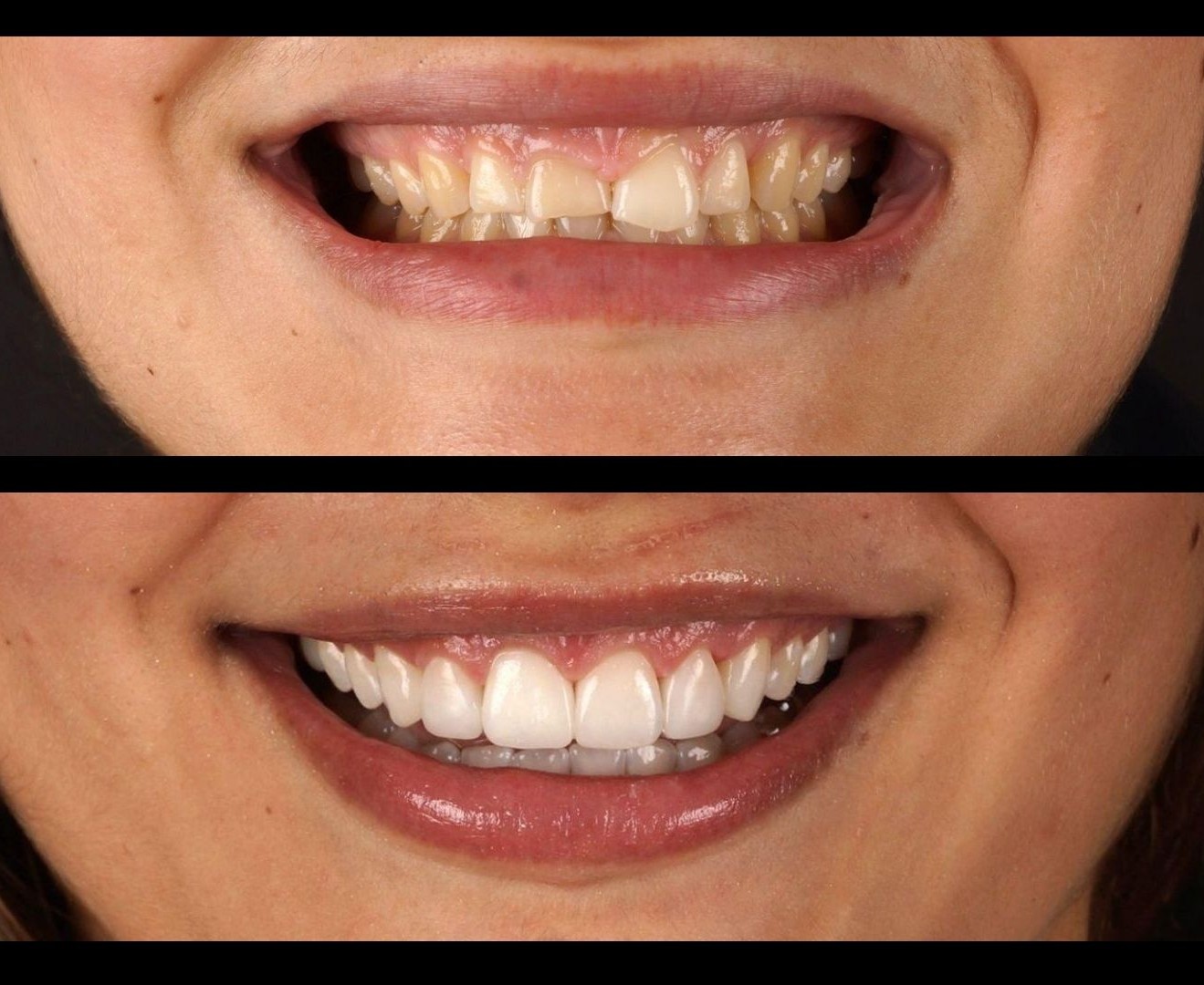valoración de dientes y encías para un diseño de sonrisa personalizado