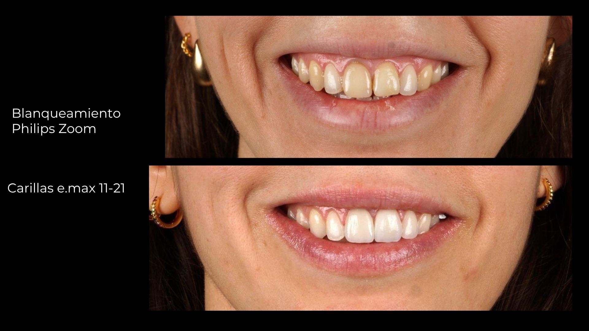 clínica dental premium SMITA Advanced Smile Design en Barcelona
