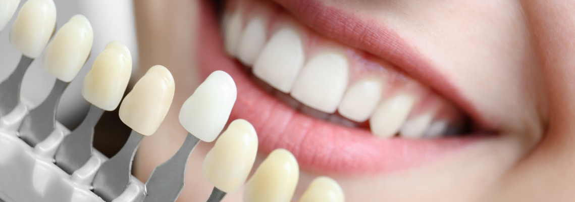 Color natural de los dientes: cómo elegir un tono bonito, luminoso y elegante