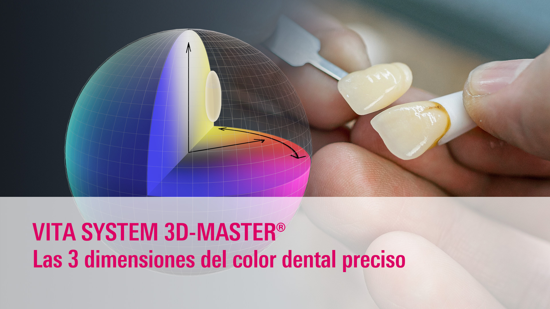 elección de color para carillas de porcelana naturales