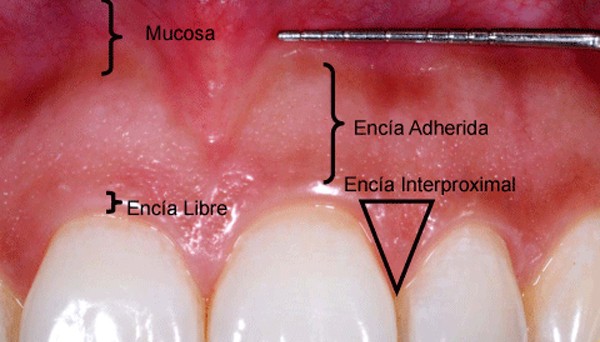 Encías y diseño de sonrisa: por qué la estética no depende solo de los dientes