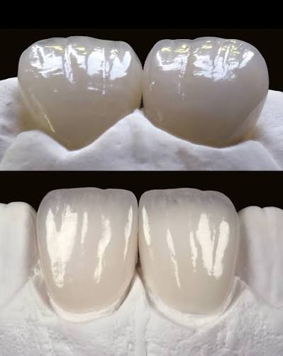 Planificación de sonrisa natural y personalizada con Digital Smile Design