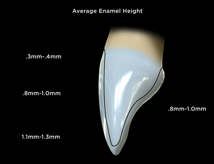 Planificación de Invisalign y carillas en SMITA Advanced Smile Design