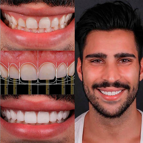 Fotografías faciales para planificación estética dental en Barcelona