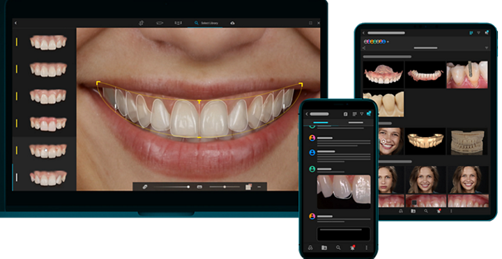 Simulación digital de sonrisa con Digital Smile Design en SMITA Barcelona